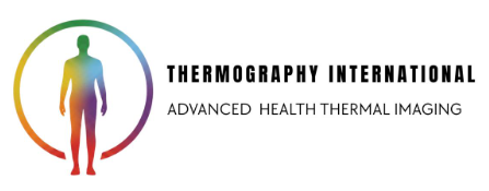 Thermo Graphy International